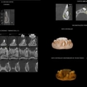 tomografia para ortodontia