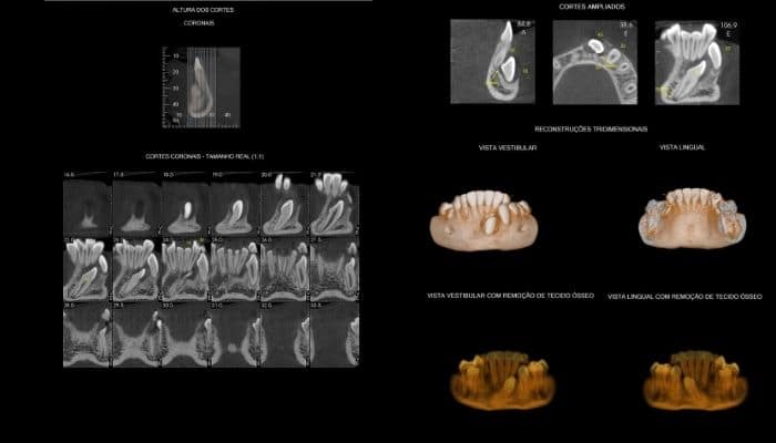 tomografia para ortodontia