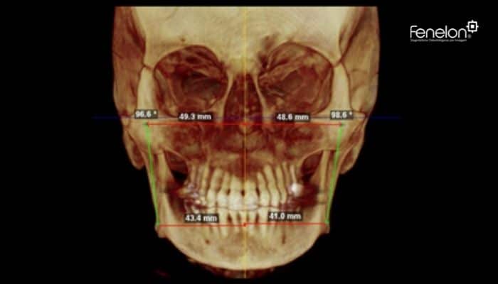 documentação ortodontica trisimensional